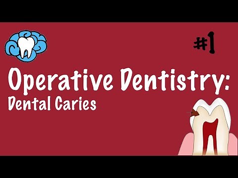 Operative Dentistry | Dental Caries | INBDE, ADAT