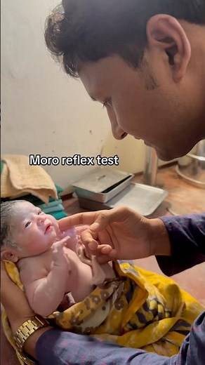 moro reflex test for examination neonatal nervous system #mororeflex