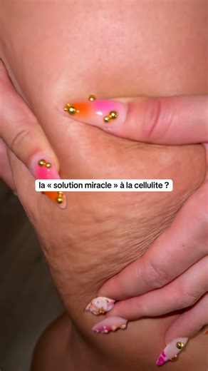 Louise on Instagram: "la cellulite n’est pas toujours un amas graisseux, ça peut également être dû à de la rétention d’eau et dans ce cas tu peux t’en débarrasser « assez facilement », évidement c’est en complément d’une bonne hygiène de vie avec une activité physique régulière et une alimentation variée. Je vais chez @healthybyade sur Insta ou planity pour celles qui voudraient tester 🤗"