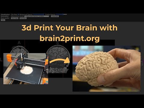 3D Print Your Brain Using brain2print.org!