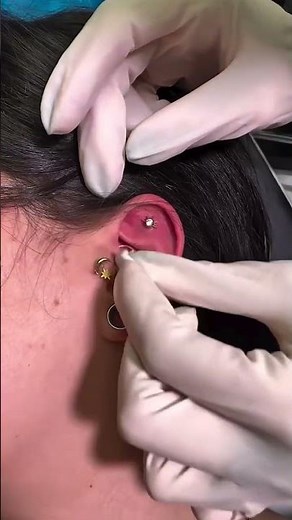 Flat & daith piercing care using Base Laboratories Hypochlorous Acid Spray