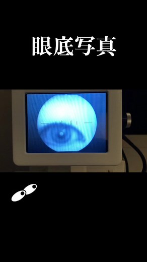 眼科の検査紹介！眼底写真、これで眼の奥の写真が撮れます！！ #眼科 #視能訓練士 #看護師 #眼底 #医療 #眼 #コンタクト #あるある