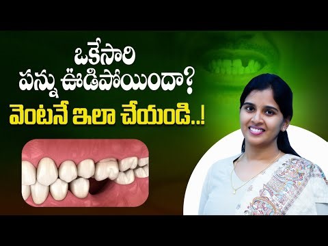 దంత అవల్షన్ అంటే ఏమిటి? | What Is Tooth Avulsion? Causes, Treatment & Care | MK Dental