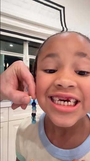 Finally Pulled Out Her Tooth! 🦷