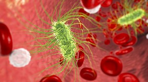 What is sepsis? Signs and symptoms of blood infection explained