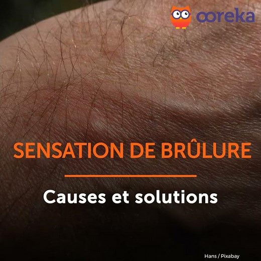 Sensations de brûlure - Causes et solutions