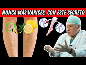 El limón elimina las varices. Hazlo todos los días...