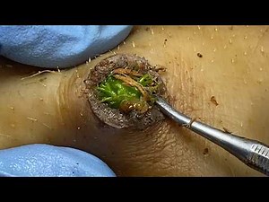 𝑭𝒂𝒄𝒊𝒂𝒍 𝑪𝒍𝒆𝒂𝒏𝒔𝒊𝒏𝒈 𝑭𝒂𝒄𝒆𝒐𝒇𝒇 𝑴𝒊𝒄𝒆𝒍𝒍𝒂𝒓 𝑾𝒂𝒕𝒆𝒓 𝒗𝒔 𝑪𝒍𝒆𝒂𝒏𝒔𝒊𝒏𝒈 𝑶𝒊𝒍 1758