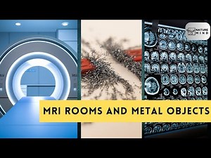 Watch What Happens When Metal Meets an MRI – Safety Demo Inside