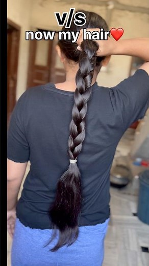 hair growth journey 📈DIY hair growth secret remedy 👀✅#haorc #hairgrowth #haircare #longhair