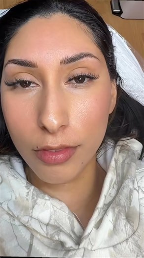 Before & after on my beautiful client ✨These are machine nano brows- a super soft pixelated technique that gives the look of natural hair without the harsh lines. Nano brows are gentler than microblading, longer lasting, and cause less trauma to the skin. If you want the most natural, low maintenance brows… this is it. 😆 | The Brow Fairy