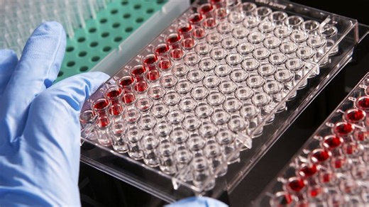 Sanofi: le CHMP recommande Dupixent pour traiter la polypose nasosinusienne sévère