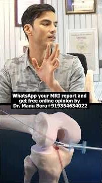 Why Does the Knee Become Stiff After ACL Surgery? | Causes & Solutions #aclrecovery