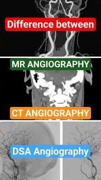 Understanding Angiography- What is the difference between MR Angio, CT angio, and DSA? #angiography