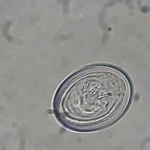 Ova of H. nana ! | Medical Laboratory Scientists