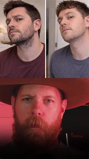 Solutions for Patchy or Thin Beards Explained