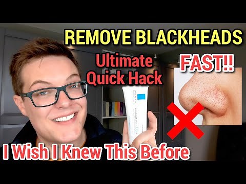 REMOVE SEBACEOUS FILAMENTS FAST - Blackhead Removal With La Roche-Posay Cicaplast Baume