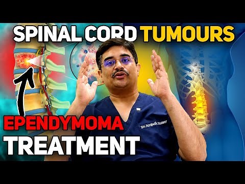 "Spinal Cord Tumors - Ependymoma: Breakthrough Treatments Explained!