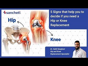 5 Signs You Need Knee or Hip Replacement | Don’t Ignore These Symptoms | Dr Sahil Sanghavi