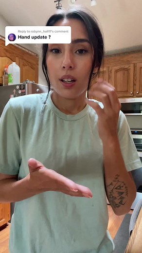 Effective First Aid Treatment with Manuka Honey