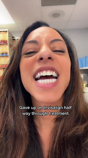 My Experience Trying Invisalign for Teeth Alignment