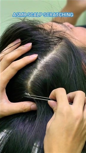 Asmr scalp scratching #asmr #scalpscratching #dandruffscratching #scalpmassage ‪@ivybasmr‬