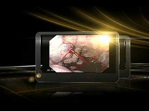 Acute Variceal Bleeding