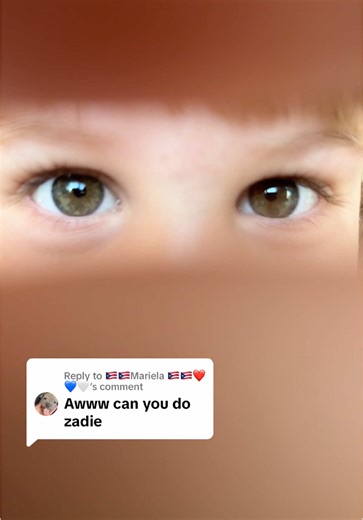 ¿Los ojos de Zadie son azules o verdes?
