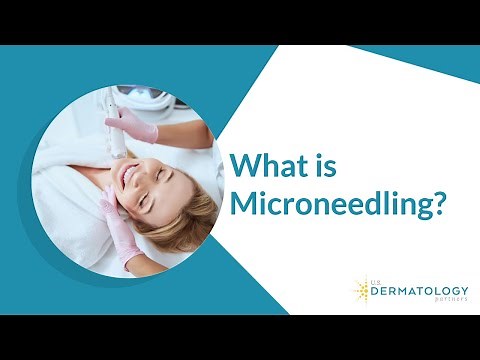 What is Microneedling? | Microneedling Treatment