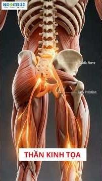 Pain in the buttocks, thighs, or heels? How to treat sciatica based on the location of the pain.