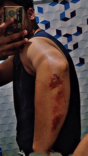 #viralfunnyvideo #1mviews #10ksubscribers #funny #riderlife 💔