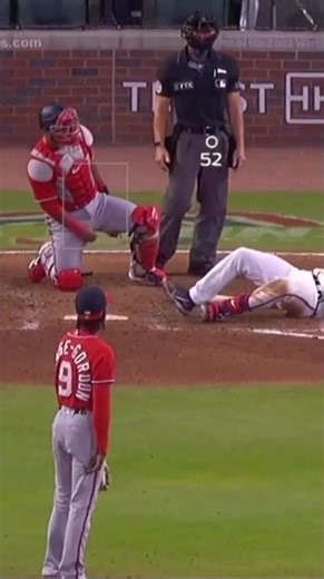 Worst Hit By Pitch in History #mlb #baseball