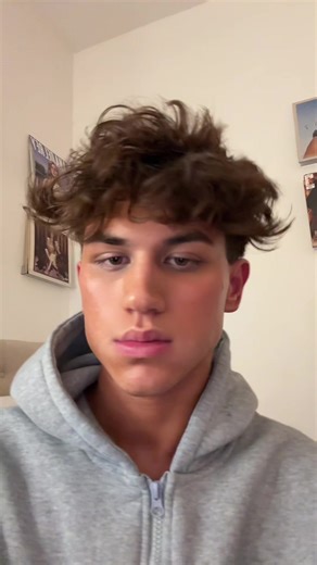 Cheekbone and jawline from the best 💉 @arielluxebeautycompanyny #fyp #filler #cheekbone