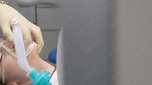 Little child under general anesthesia in hospital. Surgical intervention. Anesthesiologist at work. Breathing tube and mask on kid face. Artificial ventilation of lungs. Healthcare and life saving