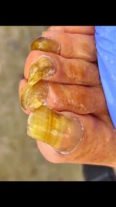 Pedicure the toenails clean | RoBi Bro's