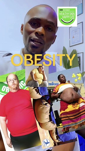 A disorder involving excessive body fat that increases the risk of health problems. Obesity often results from taking in more calories than are burned by exercise and normal daily activities. #obesisty #weightgain #frog #healthliving #health