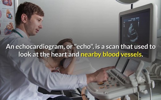 超声心动图Echocardiogram：Indications, Uses, How To Perform & Side effects