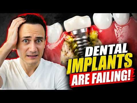 Dental implants are failing! Watch this video to know why