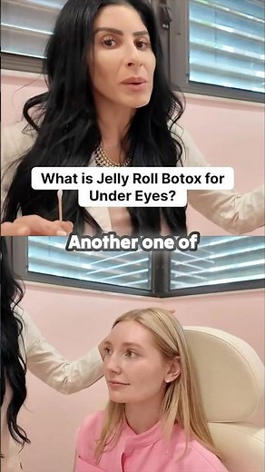 Get that doe-eyed look! ✨ Understanding Jelly Roll Botox.
