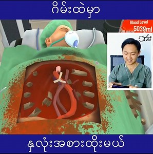 ဒီတစ်ခါတော့ A ရပြီ👌 | Dr. So Pyay