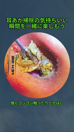 耳垢掃除の魅力と満足感