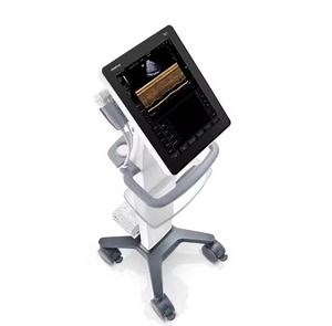 [Hot Item] Mindray TE7S Hospital Equipment Color Doppler Ultrasound Diagnostic System