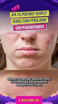 Get to Know Herpes and How It Spreads