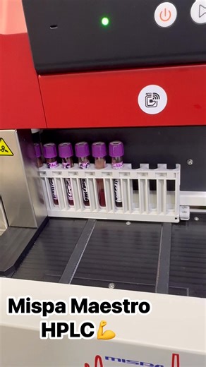 🚀✨ حصريًا مع شركة فرانس لاب ✨🚀 جهاز Mispa Maestro من شركة Agappe لتحليل HbA1c بتقنية HPLC(Variant Mode) الأكثر دقة وموثوقية 🔬 🔹 مميزات الجهاز: ✅ دقة عالية جدًا (CV ≤ 1%) ✅ تحميل مستمر حتى 50 عينة ✅ وضع STAT لحالات الطوارئ ✅ فصل دقيق للهيموجلوبين المتغير مع Variant Mode (HbS, HbC, HbD, HbE) ✅ تقليب العينات أوتوماتيكي – وحجم عينة صغير #Hba1c #HPLC France Lab Company Agappe | Emeel Helmy