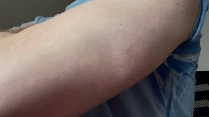 Left tricep twitching (24/7) for the last 4 days