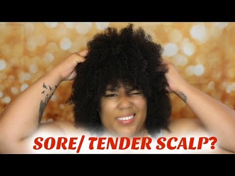 Sore/Tender Scalp? | My tips on how I treat it!