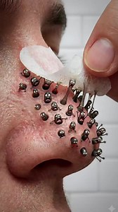 スキンケアの裏技：パック、リンゴ酢、角質ケア
