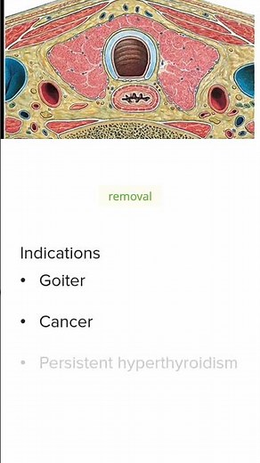 Thyroidectomy Indications Explained ✂️