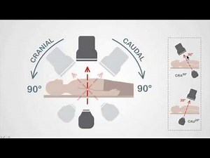 Coronary Angiography - Image Intensifier Basics And Nomenclature • Video • MEDtube.net