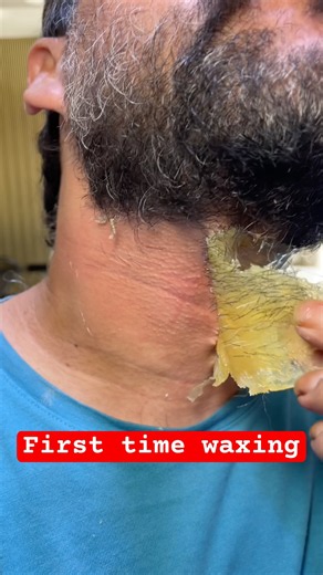 ASMR Beard Waxing 💈 Satisfying Hair Removal